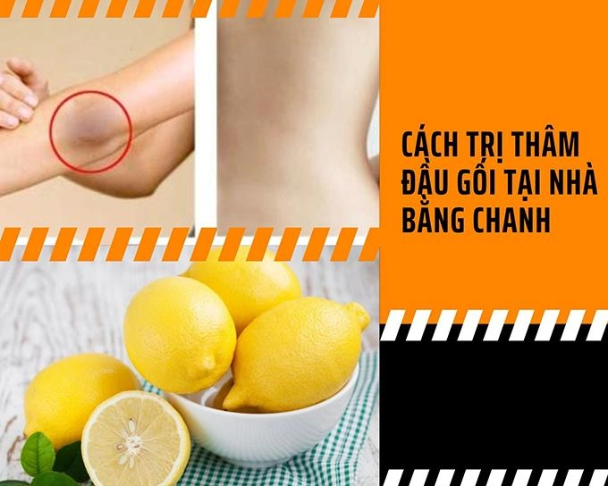 15 cách trị thâm đầu gối tại nhà nhanh nhất từ nguyên liệu tự nhiên - 12