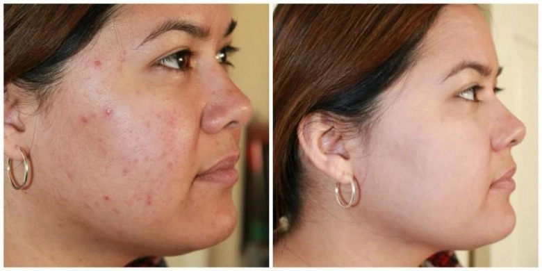 15 công thức tự làm mặt nạ nha đam tại nhà giúp nàng dưỡng da hiệu quả - 2
