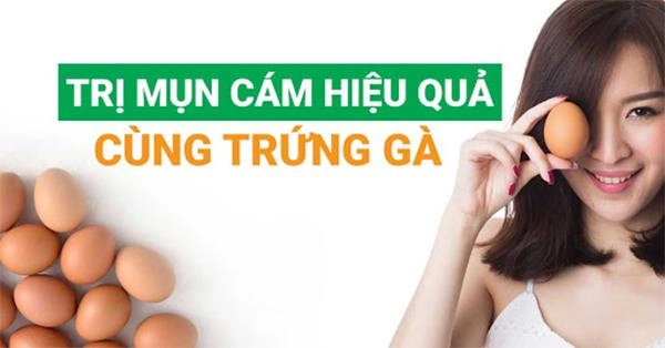 16 cách trị mụn cám tại nhà hiệu quả nhanh nhất từ thiên nhiên - 5