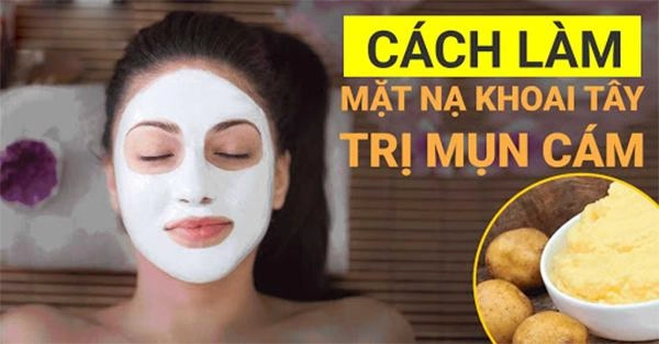 16 cách trị mụn cám tại nhà hiệu quả nhanh nhất từ thiên nhiên - 8