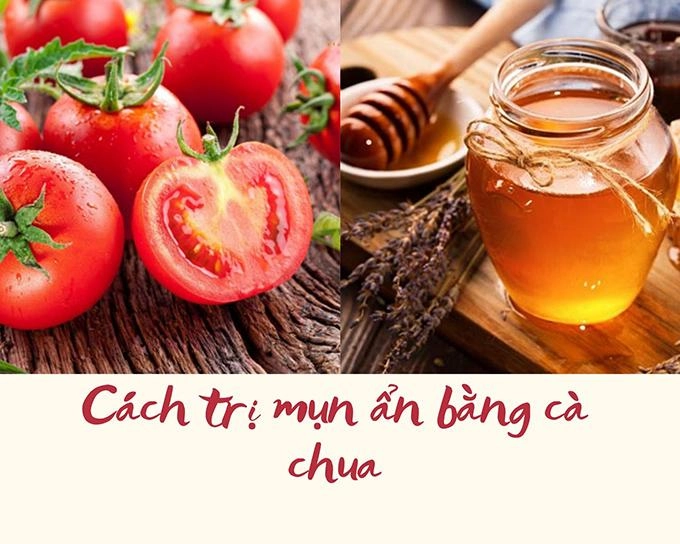 18 cách trị mụn ẩn tại nhà bằng thiên nhiên an toàn hiệu quả nhất - 19