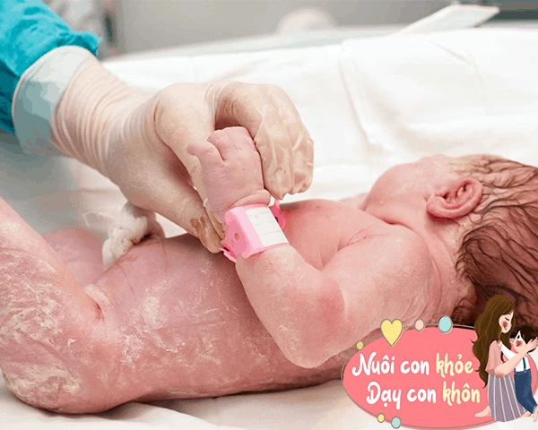 2 bộ phận trẻ sơ sinh càng xấu con càng khỏe mạnh lớn lên sẽ đẹp mẹ nên vui mừng - 3