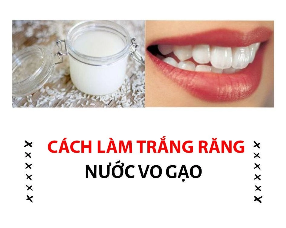 20 cách làm trắng răng tại nhà nhanh nhất hiệu quả và tiết kiệm - 4