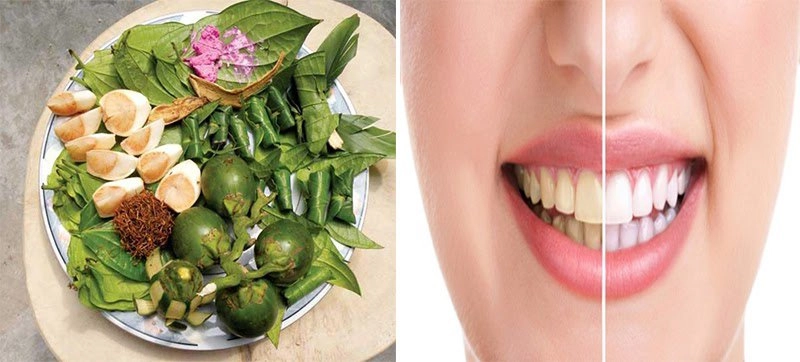 20 cách làm trắng răng tại nhà nhanh nhất hiệu quả và tiết kiệm - 11
