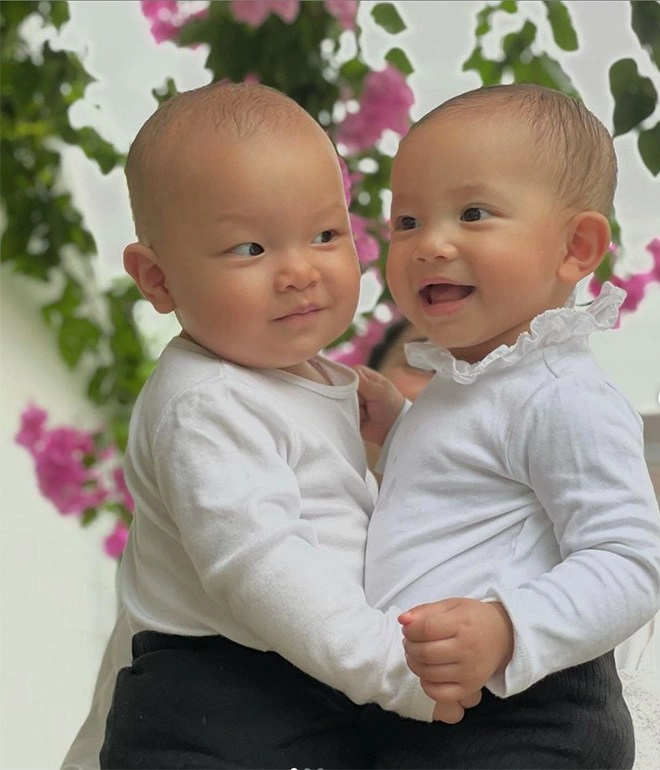 3 con sao việt chào đời náo loạn bệnh viện bác sĩ cũng thót tim giờ xinh xắn bụ bẫm - 3