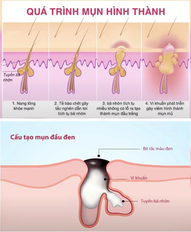 5 bí kíp thu nhỏ lỗ chân lông to và hạn chế luôn tình trạng dầu thừa không ai biết - 2