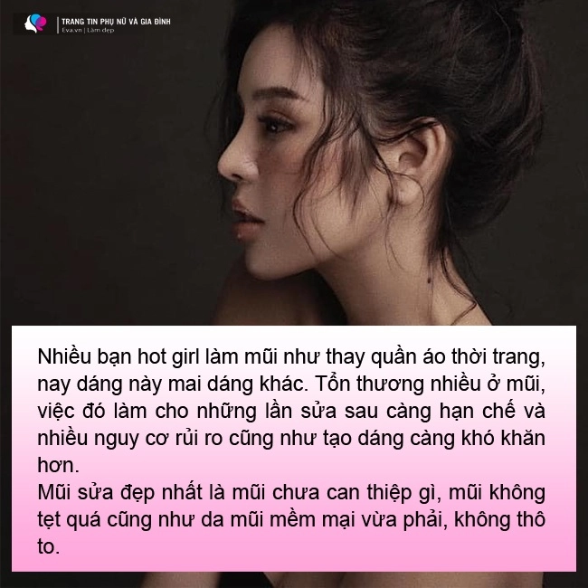 6 câu hỏi thường gặp khi nâng mũi bạn cần biết 95 mũi sau nâng sẽ có dáng chuẩn nhất - 5