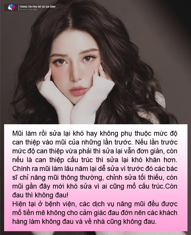 6 câu hỏi thường gặp khi nâng mũi bạn cần biết 95 mũi sau nâng sẽ có dáng chuẩn nhất - 6