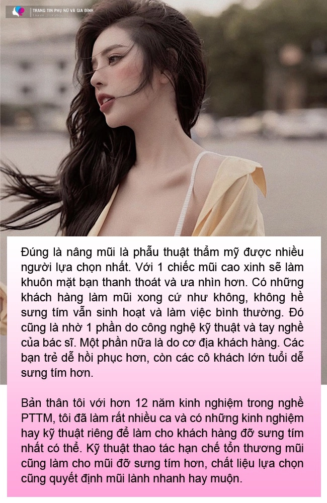6 câu hỏi thường gặp khi nâng mũi bạn cần biết 95 mũi sau nâng sẽ có dáng chuẩn nhất - 2