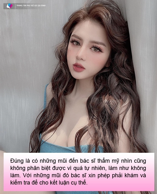 6 câu hỏi thường gặp khi nâng mũi bạn cần biết 95 mũi sau nâng sẽ có dáng chuẩn nhất - 7