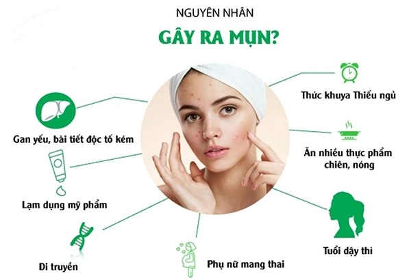 8 cách trị mụn bọc sưng đỏ an toàn hiệu quả không để lại vết thâm - 1