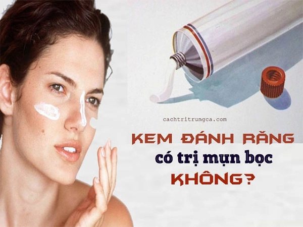 8 cách trị mụn bọc sưng đỏ an toàn hiệu quả không để lại vết thâm - 2