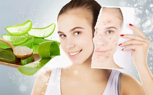 8 cách trị mụn bọc sưng đỏ an toàn hiệu quả không để lại vết thâm - 5