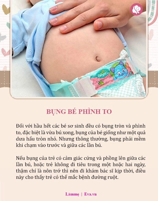 8 dấu hiệu bất thường ở trẻ sơ sinh đừng chần chừ hãy đưa con đi khám ngay - 2