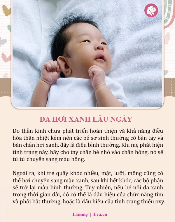 8 dấu hiệu bất thường ở trẻ sơ sinh đừng chần chừ hãy đưa con đi khám ngay - 3