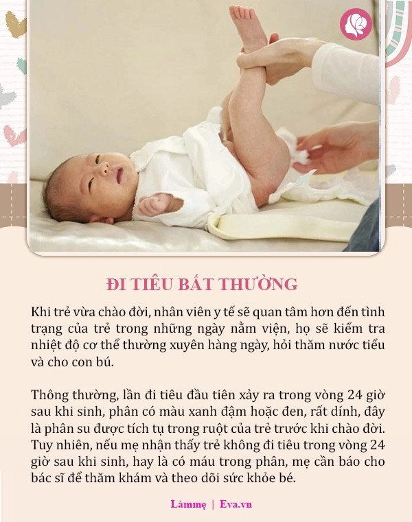 8 dấu hiệu bất thường ở trẻ sơ sinh đừng chần chừ hãy đưa con đi khám ngay - 4