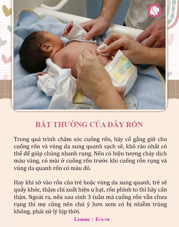 8 dấu hiệu bất thường ở trẻ sơ sinh đừng chần chừ hãy đưa con đi khám ngay - 9