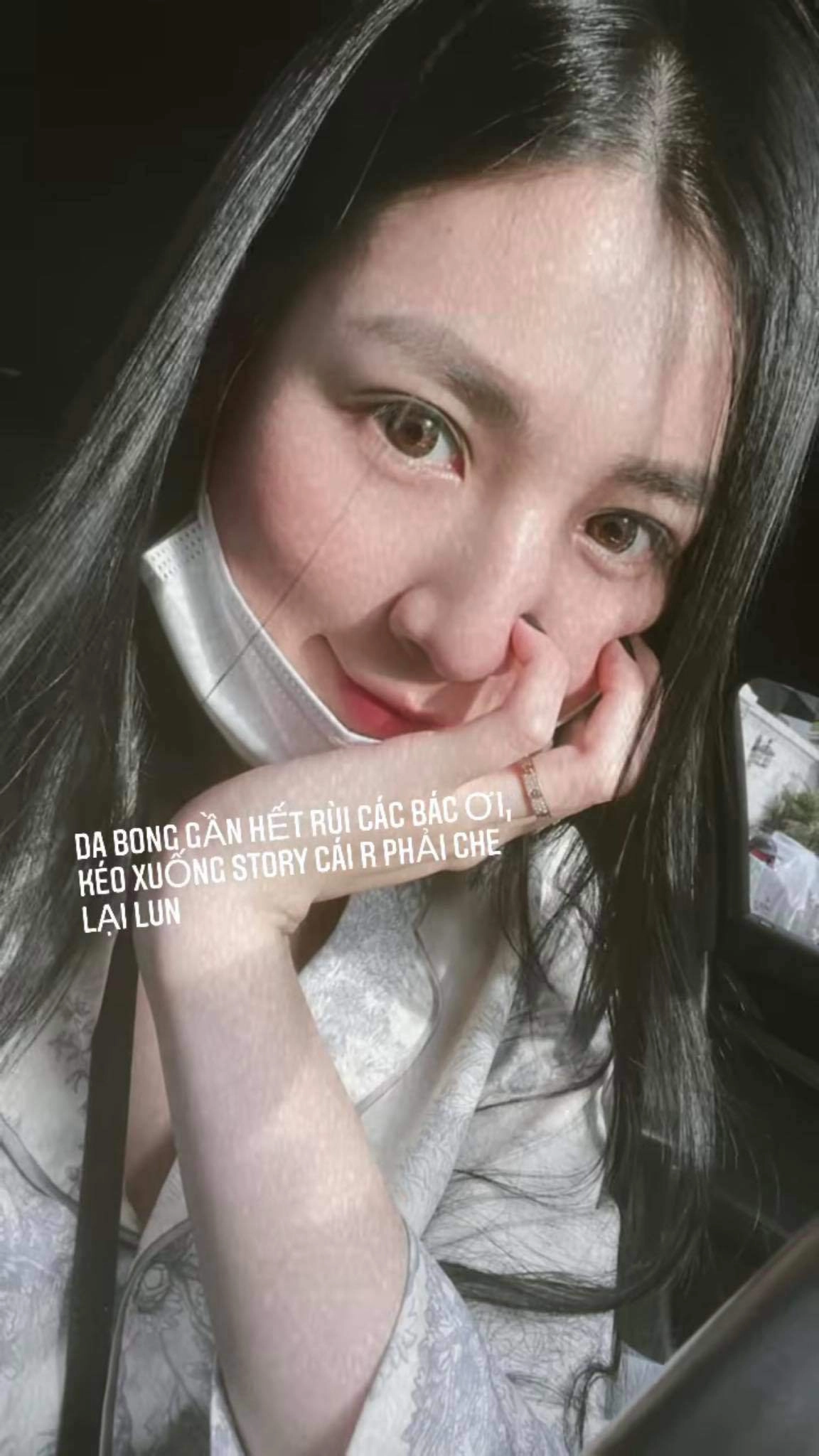 Á hậu dương tú anh cách ly mạng xã hội vì gương mặt bong tróc nham nhở - 4