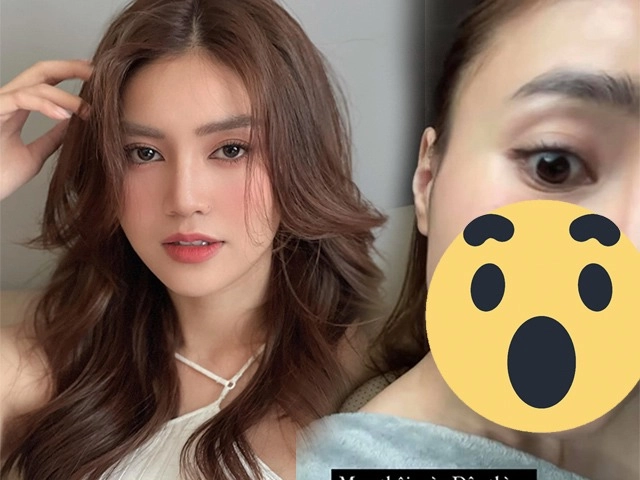 Á hậu dương tú anh cách ly mạng xã hội vì gương mặt bong tróc nham nhở - 9