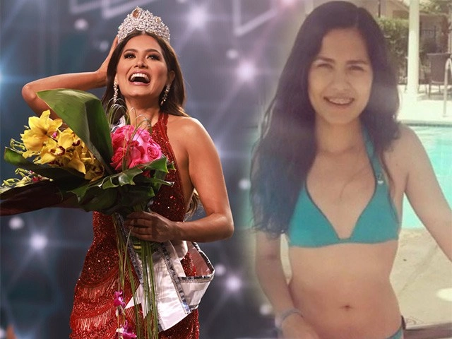 Á hậu kim duyên nói về việc thẩm mỹ đến với miss universe nếu đẹp thì đáng để làm - 21