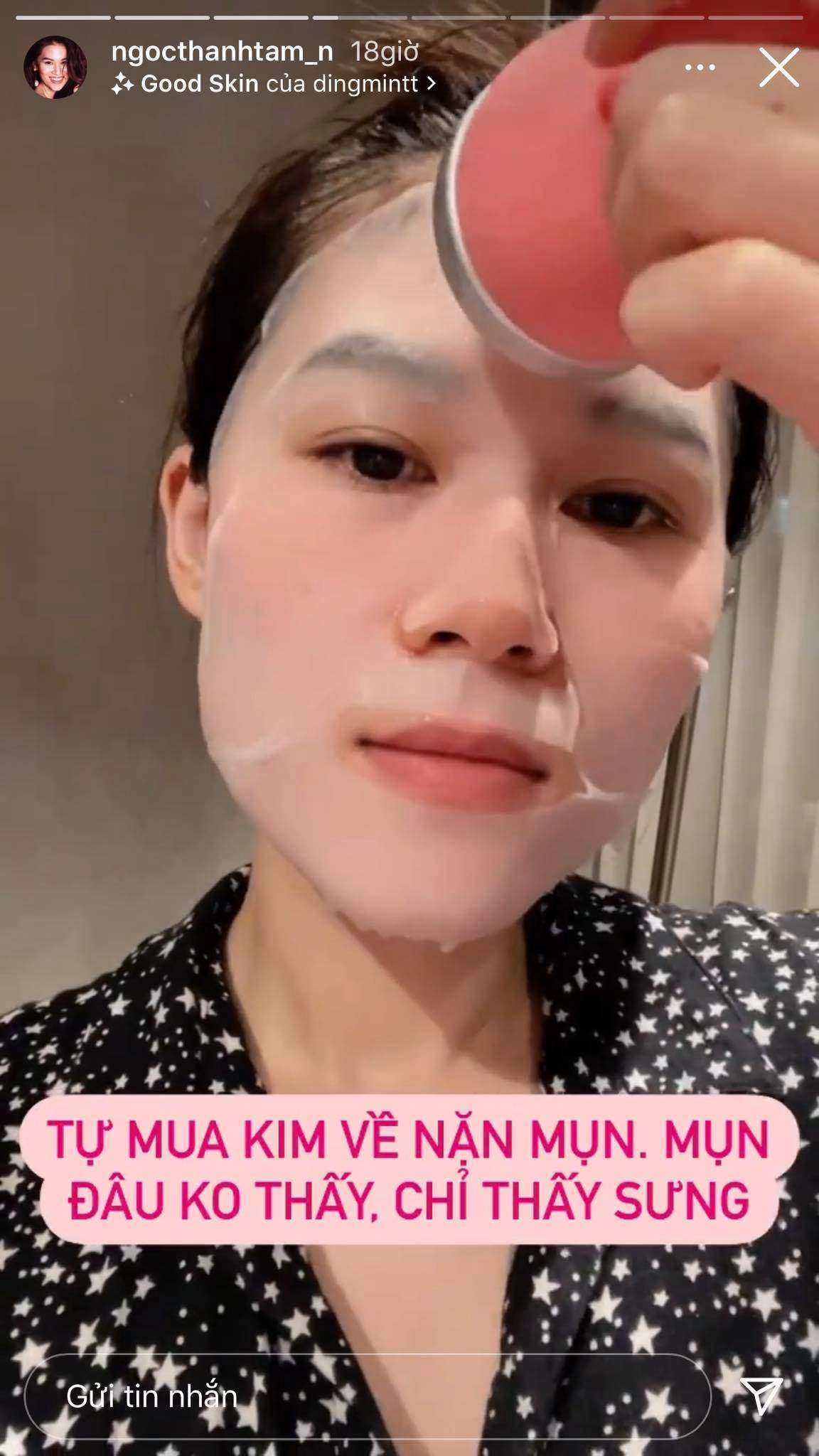 Ái nữ đại gia ngọc thanh tâm tự mua kim nặn mụn làn da nhận cái kết đắng - 5