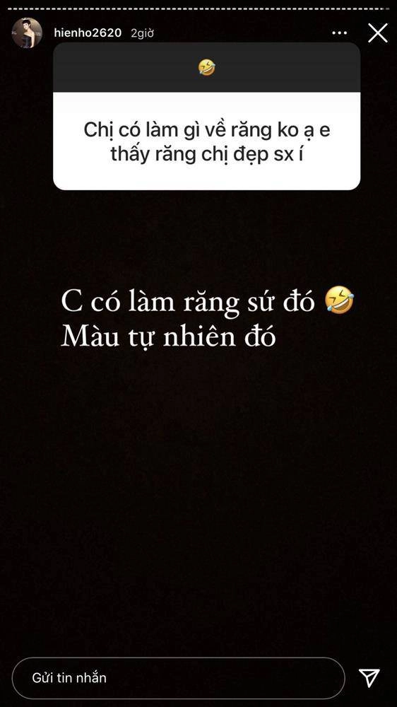 Ảnh xưa và nay đổi khác hiền hồ chối cắt mí nhưng vẫn thừa nhận có làm mí mắt - 7
