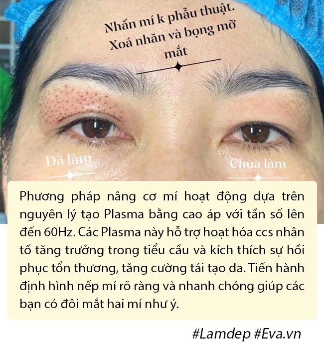 Ảnh xưa và nay đổi khác hiền hồ chối cắt mí nhưng vẫn thừa nhận có làm mí mắt - 11