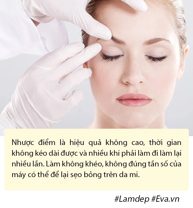 Ảnh xưa và nay đổi khác hiền hồ chối cắt mí nhưng vẫn thừa nhận có làm mí mắt - 13