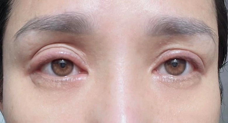 Bà mối cát tường gặp nạn làm đẹp chị em không cẩn thận cũng dễ mắc phải - 3