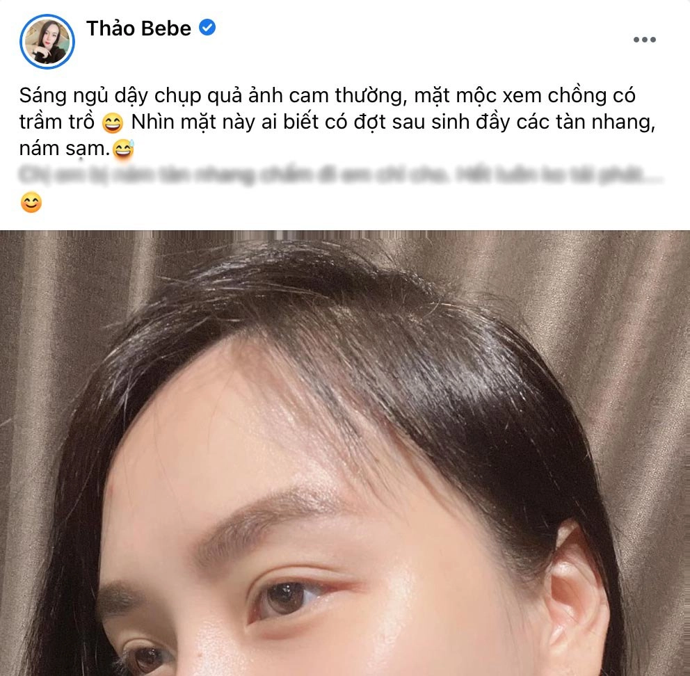 Bà xã dj của khắc việt bê mặt mộc lên sóng ai nghĩ sau sinh đầy tàn nhang nám sạm - 4