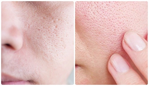 Bạn đang làm những việc khiến lỗ chân lông nở toang hoác mỗi ngày dừng ngay còn kịp - 1