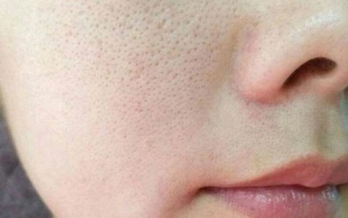 Bạn đang làm những việc khiến lỗ chân lông nở toang hoác mỗi ngày dừng ngay còn kịp - 2