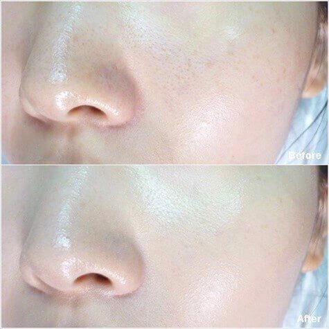 Bạn đang làm những việc khiến lỗ chân lông nở toang hoác mỗi ngày dừng ngay còn kịp - 14