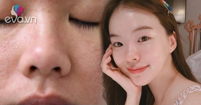 Bạn đang làm những việc khiến lỗ chân lông nở toang hoác mỗi ngày dừng ngay còn kịp - 34