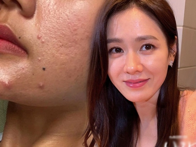 Bạn đang làm những việc khiến lỗ chân lông nở toang hoác mỗi ngày dừng ngay còn kịp - 39