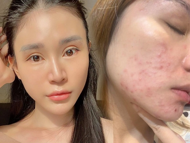 Triệt phá kho mỹ phẩm fake hội nghiện skincare tá hoả vì có chai kem chống nắng quốc dân - 15