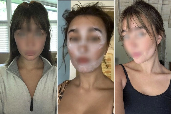 Bắt chước clip tiktok làm đẹp bình dân tại nhà bóng hồng người úc tự tay huỷ hoại da dẻ - 8