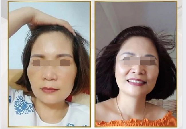 Bất ngờ chuyện cải lão hoàn đồng ra cả chục tuổi chỉ nhờ vài chục phút độn thái dương - 2