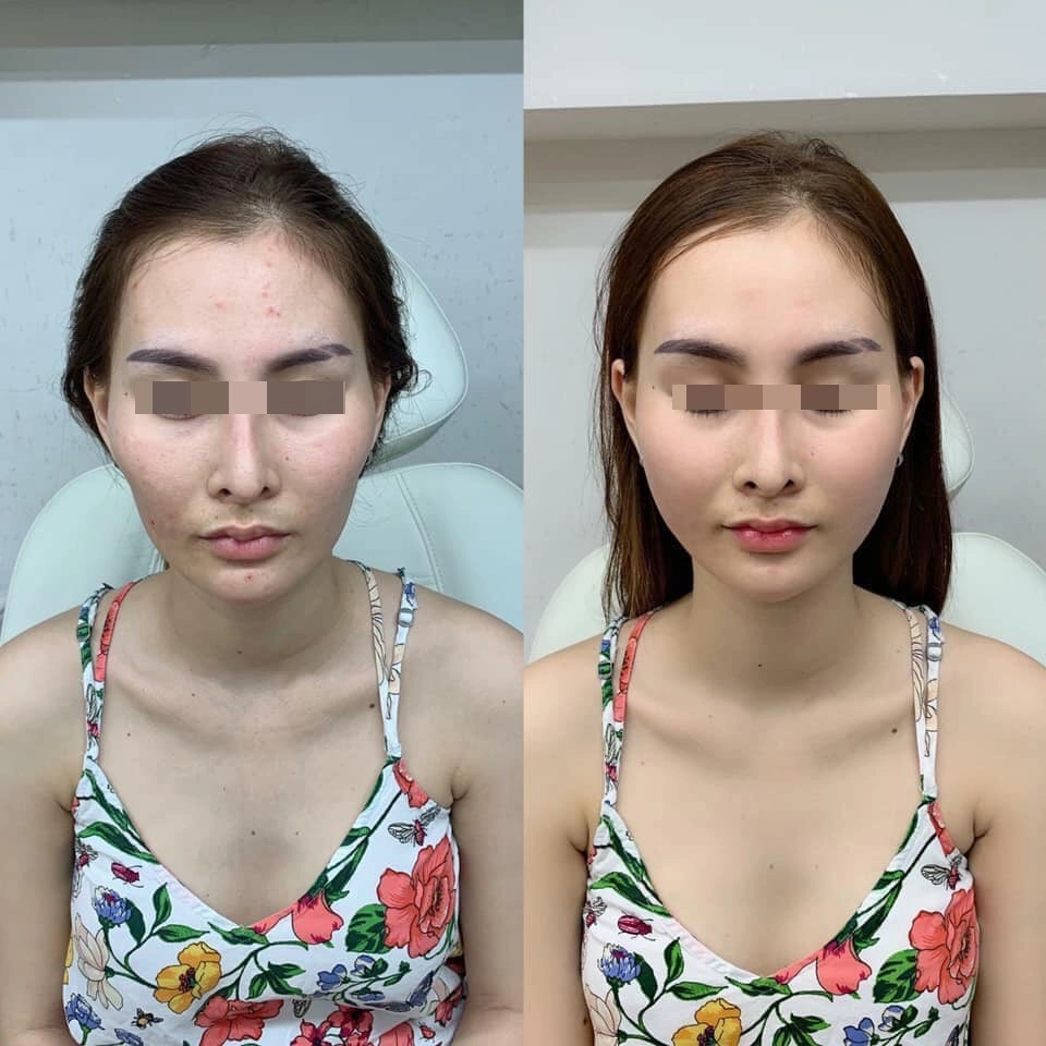 Bất ngờ chuyện cải lão hoàn đồng ra cả chục tuổi chỉ nhờ vài chục phút độn thái dương - 4