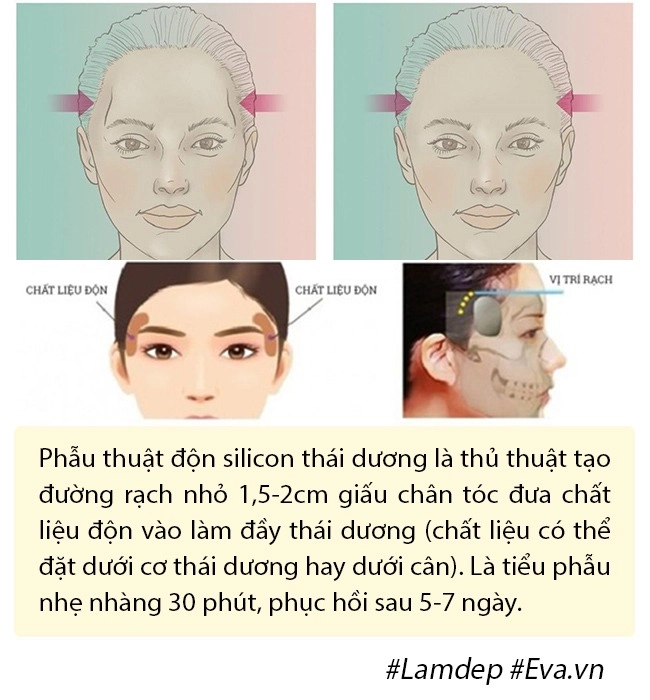 Bất ngờ chuyện cải lão hoàn đồng ra cả chục tuổi chỉ nhờ vài chục phút độn thái dương - 5