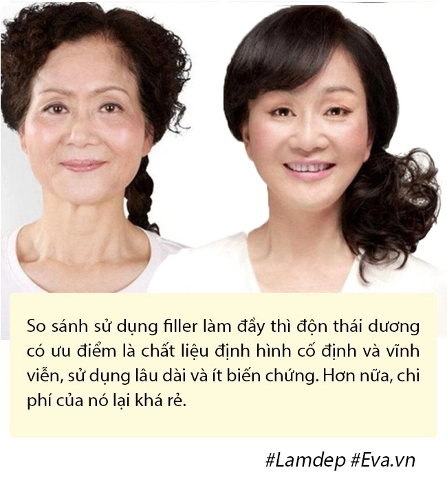 Bất ngờ chuyện cải lão hoàn đồng ra cả chục tuổi chỉ nhờ vài chục phút độn thái dương - 6