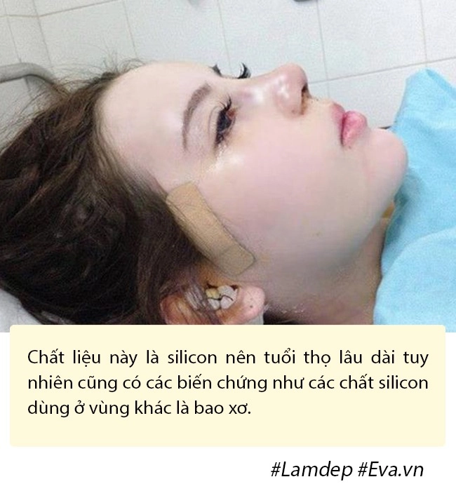 Bất ngờ chuyện cải lão hoàn đồng ra cả chục tuổi chỉ nhờ vài chục phút độn thái dương - 8