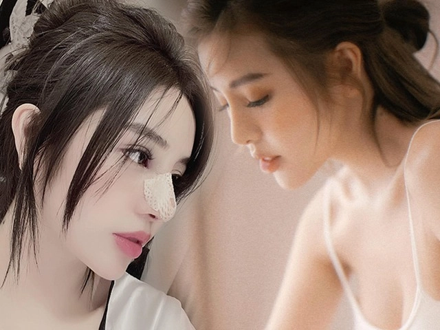 Bất ngờ chuyện cải lão hoàn đồng ra cả chục tuổi chỉ nhờ vài chục phút độn thái dương - 10