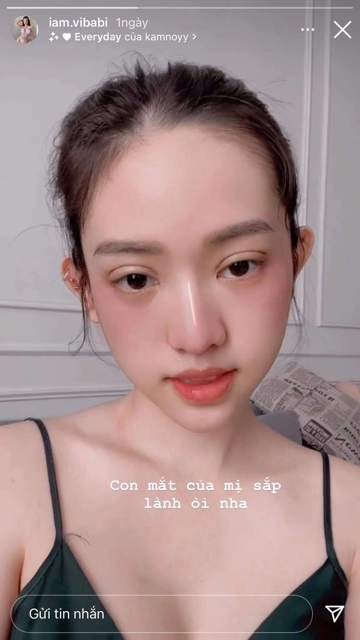 Bất ngờ với tin thúy vi dao kéo lần thứ n nhan sắc làm đi làm lại liệu còn đẹp - 2