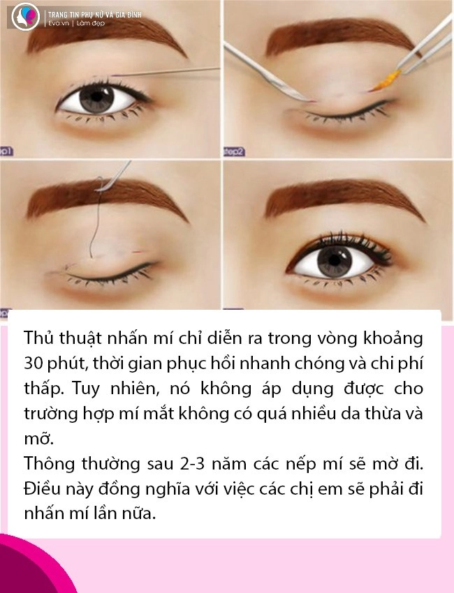 Bất ngờ với tin thúy vi dao kéo lần thứ n nhan sắc làm đi làm lại liệu còn đẹp - 8