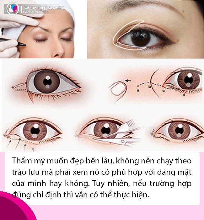 Bất ngờ với tin thúy vi dao kéo lần thứ n nhan sắc làm đi làm lại liệu còn đẹp - 12