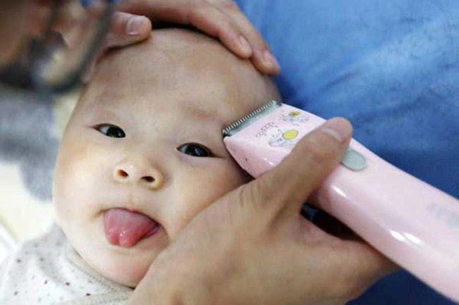 Bé 1 tuổi chi chít vết bầm trên người bà nội giải thích để cứu cháu bác sĩ lắc đầu - 3