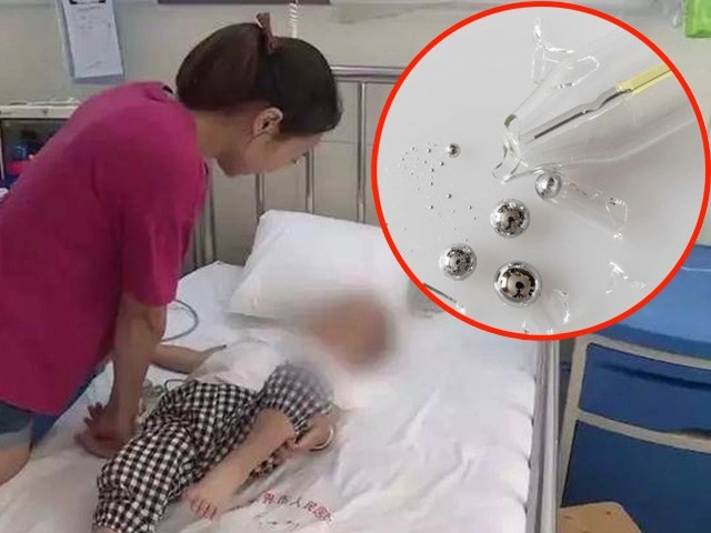 Con nhỏ keo 502 vào mắt mẹ đắp thêm khăn tẩm nước được bác sĩ khen quá thông minh - 4