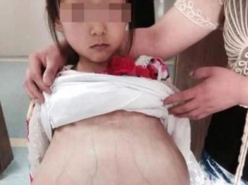 Bé gái 11 tuổi chuyển dạ sinh con giữa đêm biết danh tính người đi cùng bác sĩ choáng váng - 2