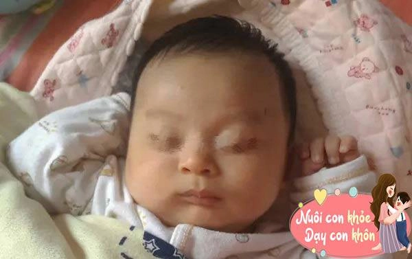 Bé sơ sinh bị bà nội dỗ nín khóc đến thành bại não mẹ trẻ gào khóc ân hận - 2